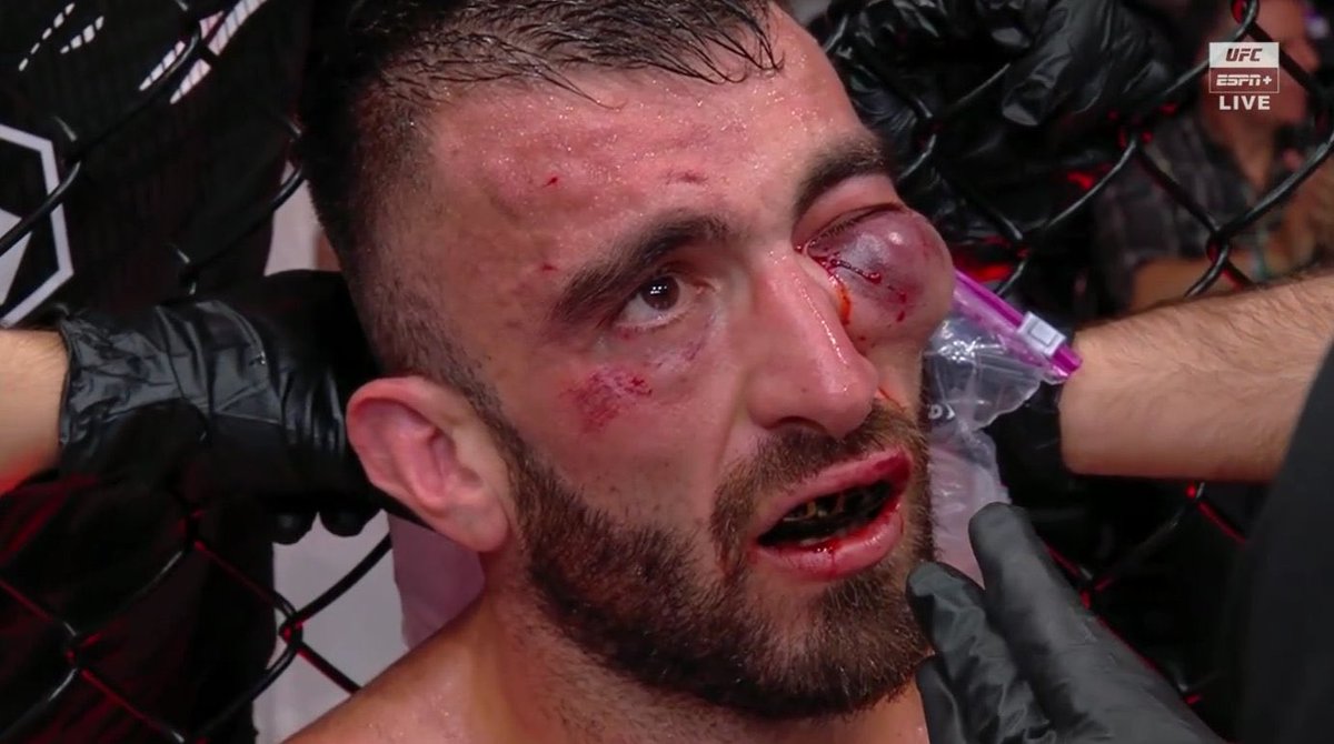 No words. 😱 #UFCAbuDhabi