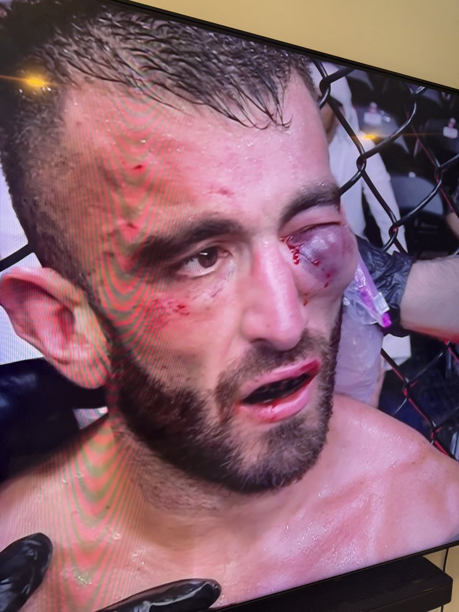 Flowersbyfidels's tweet image. this fight should have been stopped alot earlier #UFCAbuDhabi