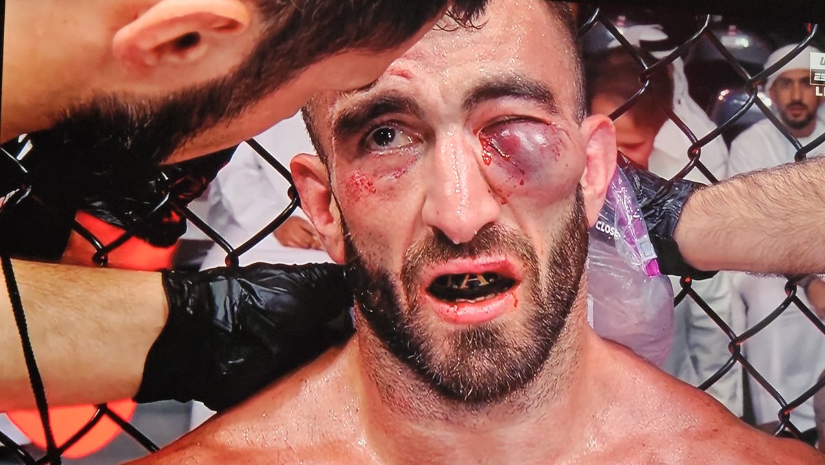bitsalot's tweet image. That&apos;ll buff out. #UFCAbuDhabi
