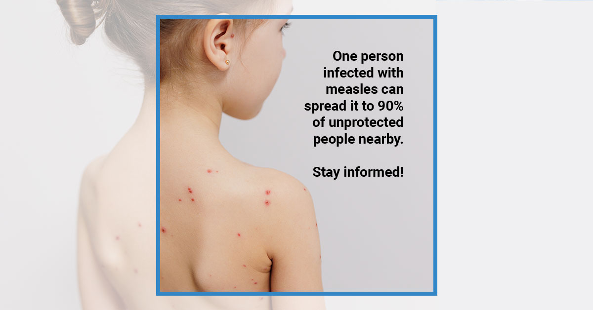 Measles is EXTREMELY contagious!  

One person with measles = 90% infection rate for unprotected people nearby. 

Get your measles vaccine to protect yourself and others.  

ow.ly/ZpLT50WuXhT