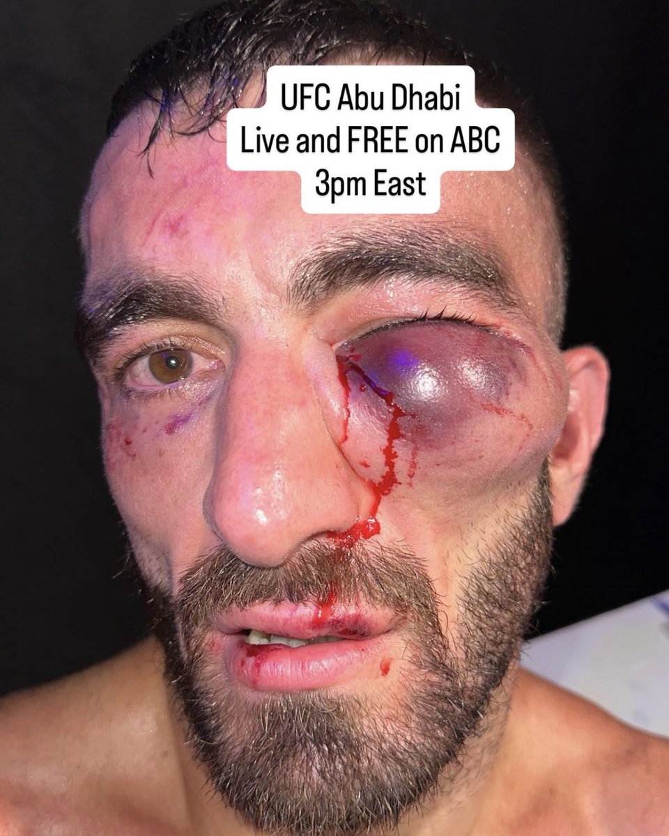 ‼️ Mohammad Yahya’s eye is a mess 😱

📸 <a href="/danawhite/">danawhite</a> #UFCAbuDhabi