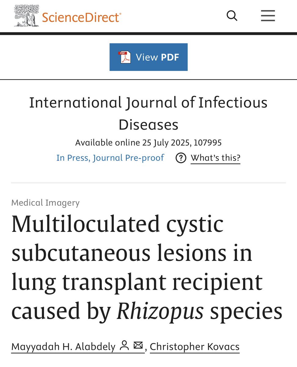 ccf_idfellows's tweet image. Huge congratulations to our transplant ID fellow, Dr. Alabdely, on her latest publication! So proud of your incredible work 👏🏆
sciencedirect.com/science/articl…
@sciencedirect @Mayyadah_HA @chriskovacsmd
#infectiousdiseases #MedEd #publication #transplantID