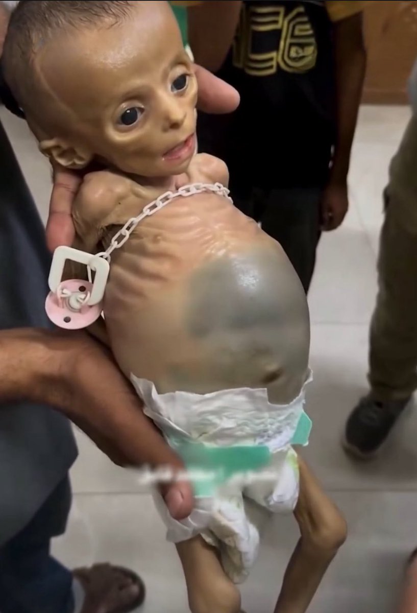 ErdemOzveren571's tweet image. Hepimiz ALLAH'a Hesap Vereceğiz ⚠️
🌍 #HungerIsNotAWeapon 🇵🇸
