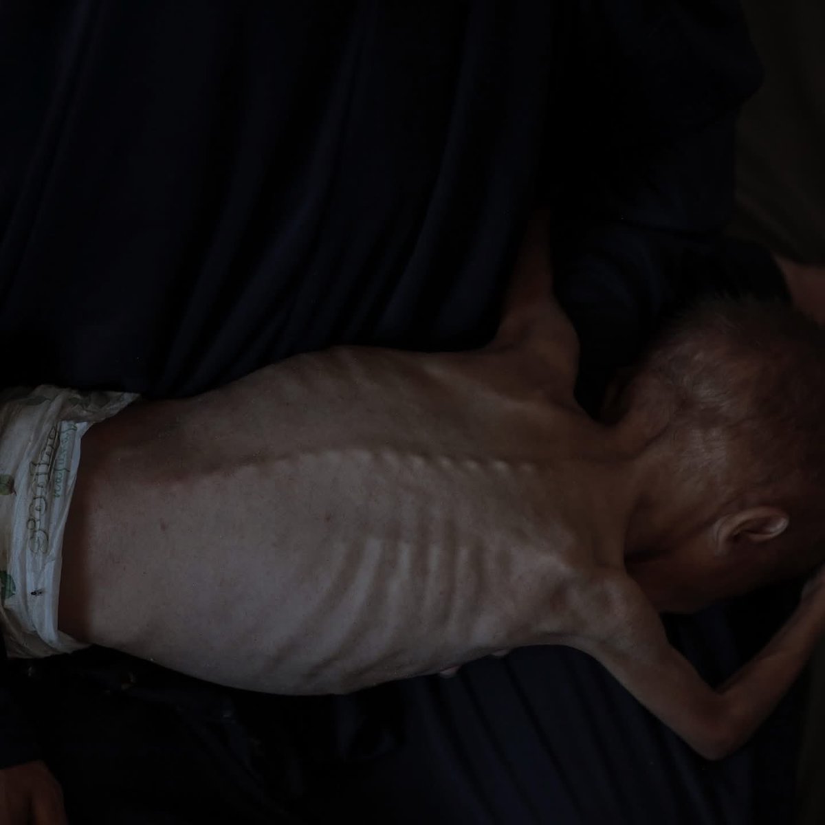 Açlık Silah Değildir!
#HungerIsNotAWeapon