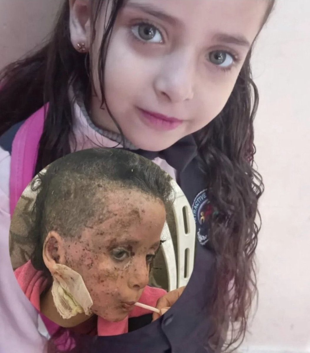 If you see this little angel, reply with 🇵🇸 pray for her.