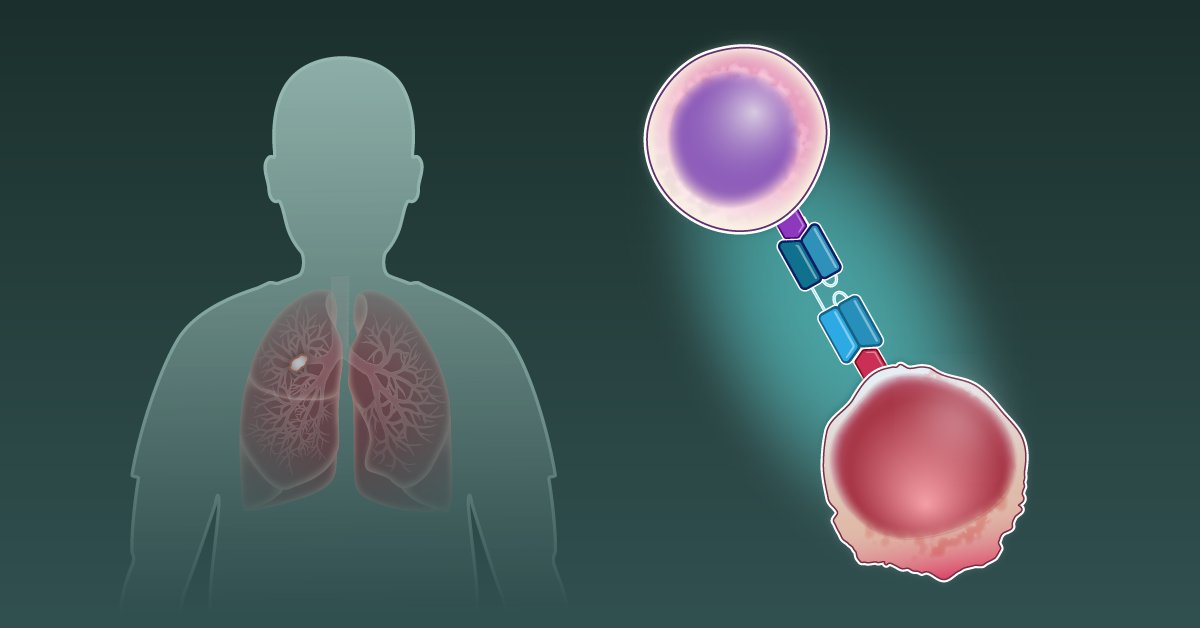 NEJM's tweet image. Small-cell lung cancer that relapses after platinum chemotherapy has few effective treatment options. The DeLLphi-304 phase 3 trial shows improved survival and symptom control with the DLL3-targeted T-cell engager tarlatamab. nej.md/4kWVuyB