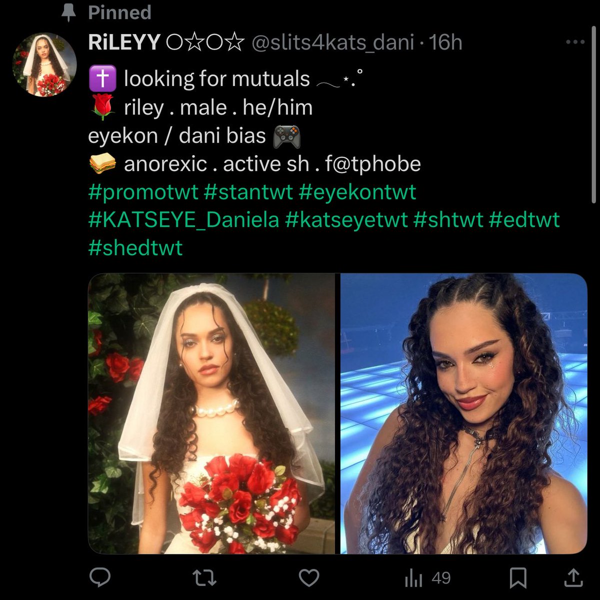UPROTECTKATSEYE's tweet image. ‼️ #PROTECTKATSEYE ‼️
Block and report
Do NOT engage ⚠️
Click the 3 dots select suicide or self-harm then asking for encouragement to engage in self-harm.
🔗: x.com/slits4kats_dani