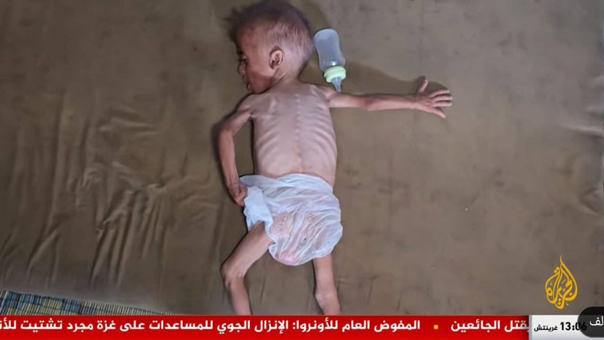 In the silence of global indifference, an Israeli-made famine is choking Gaza’s most vulnerable. What was once condemned as #Nazi cruelty now resurfaces repackaged, rebranded, and unleashed upon Palestinians by the crazy death cult in Tel Aviv.