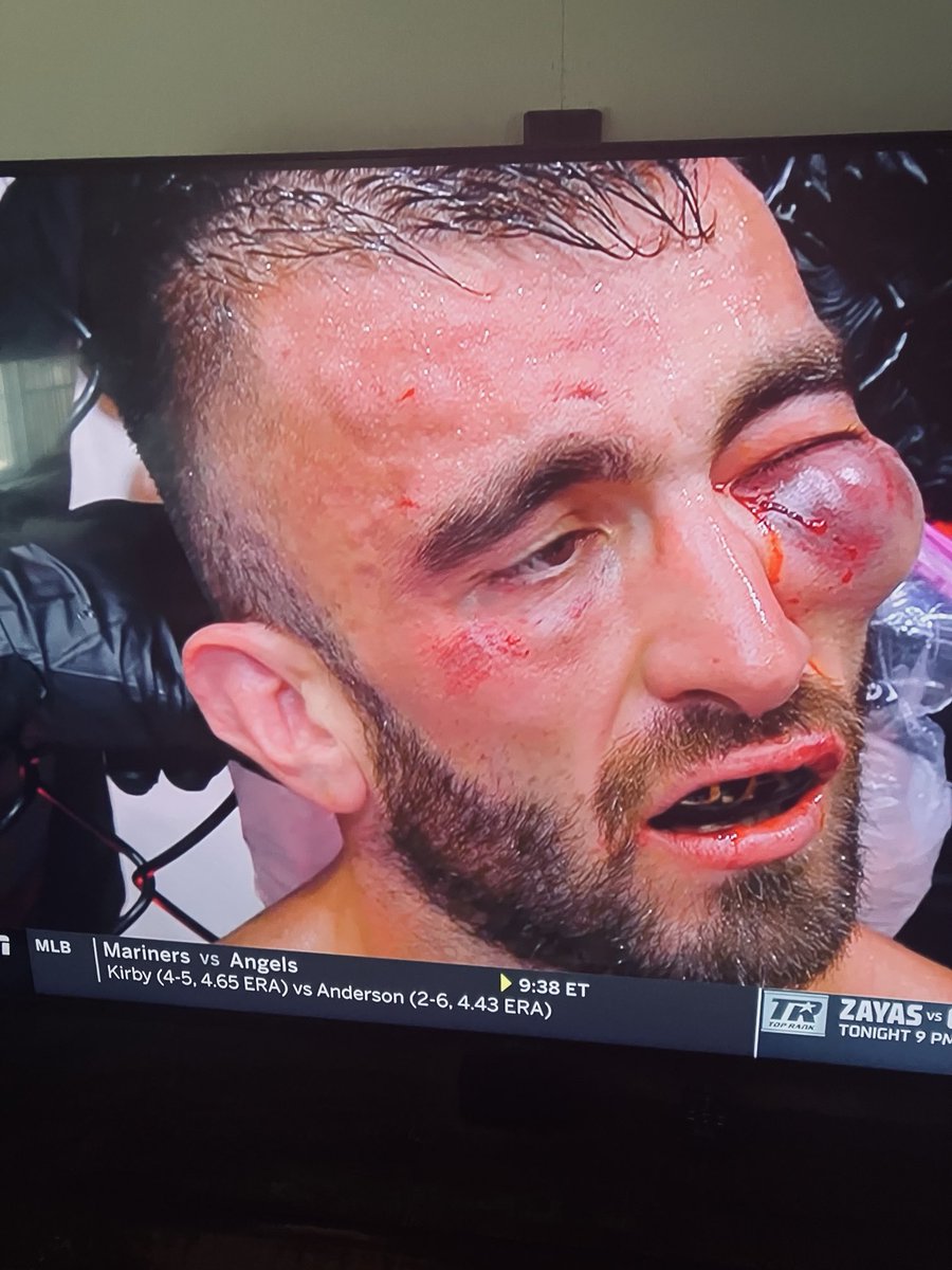 USStallion's tweet image. Good reason for a stoppage.