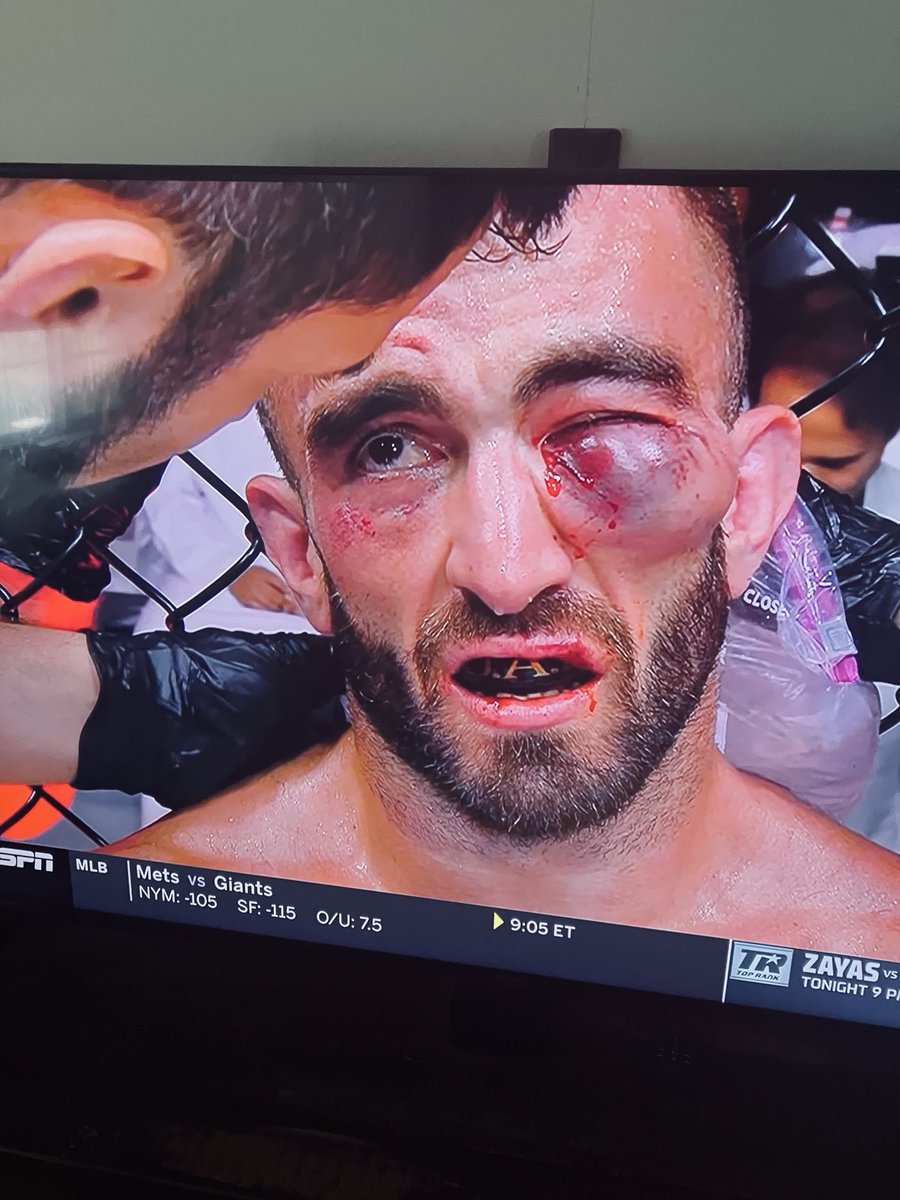 USStallion's tweet image. Good reason for a stoppage.