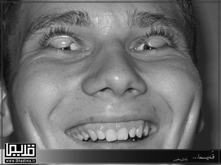 زمان شما ام نمکدون های فامیل بچهارو با این حرکت برگردوندن پلک‌میترسوندن؟ 
🍑نمک لوس