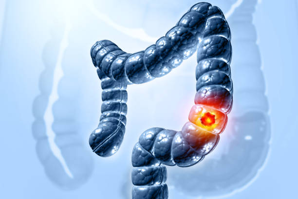 BCMCME's tweet image. Did you know colon cancer can be silent until it’s too late? "Colon cancer- screening, diagnosis, and beyond."
A panel full of talented GI physicians @milenasuarez @AtifIqbalMD @ShaliniMakawita, and Dr. Vani Potluri cover how to screen smarter, diagnose earlier, and treat…