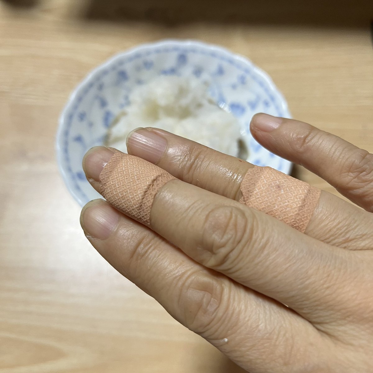 大根おろしで、軽傷を負ってしまいました🥲