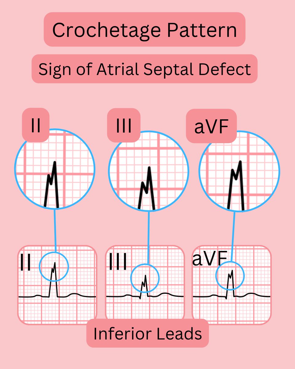 ECGsmart tweet media