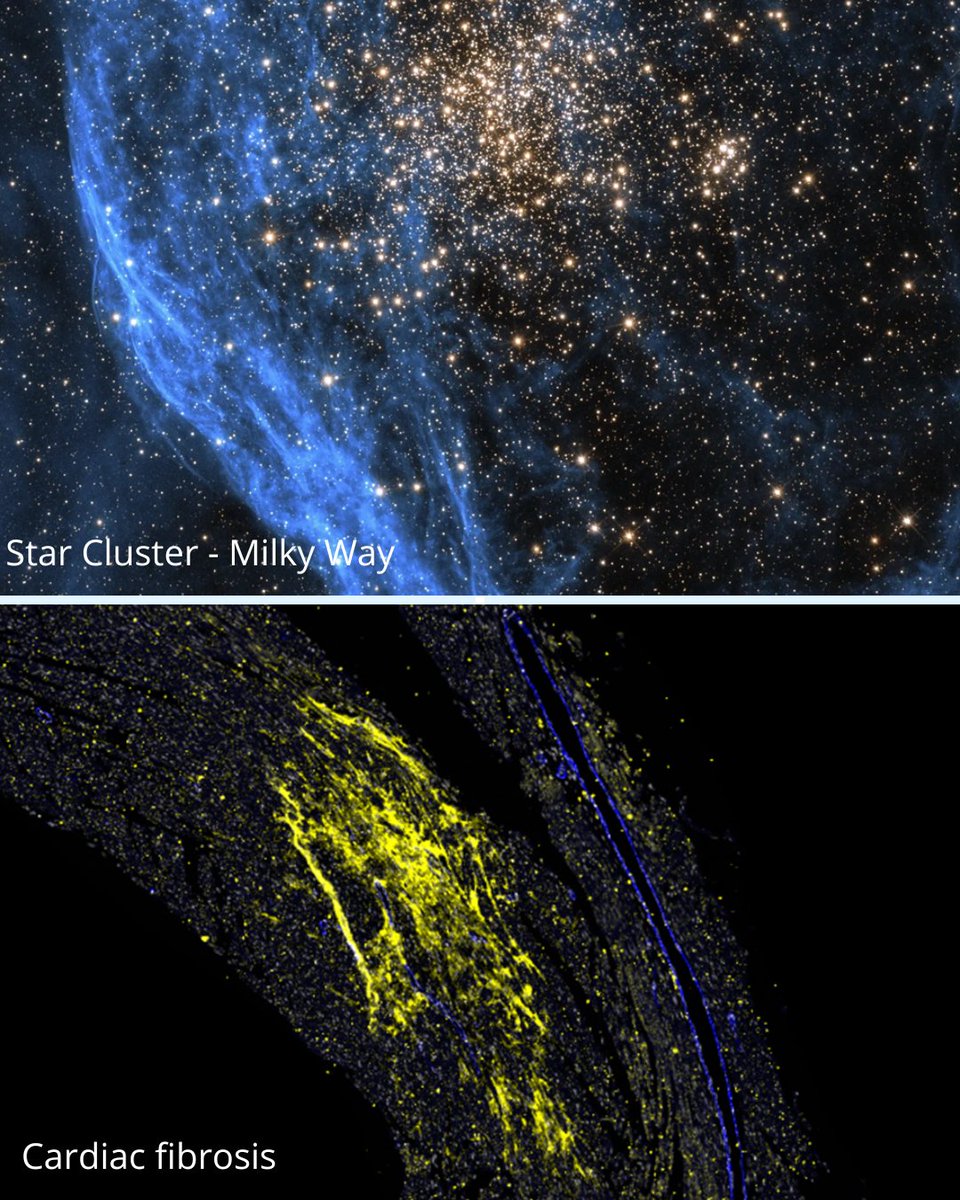 Stardust or scar tissue?✨ One lights up the night sky. The other dims the heart’s power. This is cardiac fibrosis — scar tissue that forms after heart damage. We want to prevent this damage — so hearts can keep beating strong ❤️ #NationalScienceWeek2025. Photo: <a href="/CrisdionKrstev1/">Crisdion Krstevski</a>