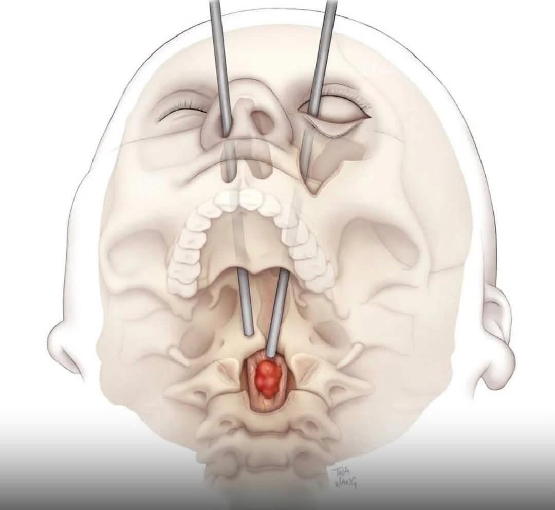 next piercing