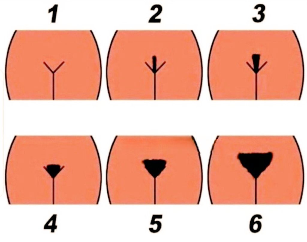 Which do you prefer? 🤔