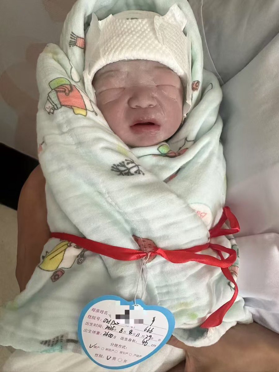 【报喜篇🌻】
2025年8月8日11:29，
我们再次见证了一个5.2斤试管宝宝的平安降生！
母子平安，新生命的第一声啼哭温暖了整个产房。咨询微信：a18025307951
#HIV生子 #三代代孕 #失独代孕 #包成功代孕 #洗精代孕 #三代包成功 #选性别代孕 #男性代孕 #夫妻代孕 
#试管婴儿 #试管助孕 #代孕 #广州代孕