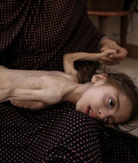 "في غزة، يُعلَن عن وفاة شخص كل ساعة بسبب الجوع."