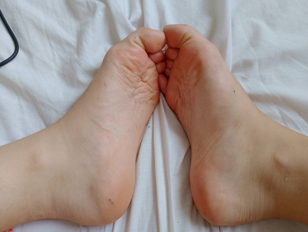 OneGirlSixToes's tweet photo. ewww, that summer kills me, my flip flops are sticky and dirty, im tooo lazy to wash them ;)
#footfetısh #barefoot #polydactyl #6toes https://t.co/Gfjm7h7meW