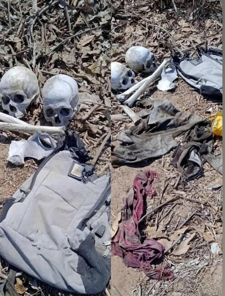 Dua rakyat Palestin ditemui berhampiran Hospital Turki di Gaza hanya tinggal rangka dengan fizikal yang telah hancur sepenuhnya.

Pihak keluarga mungkin hanya dapat mengenal pasti jenazah mereka melalui pakaian yang masih melekat pada tubuh/beg kecil yang terletak di sisi mereka.