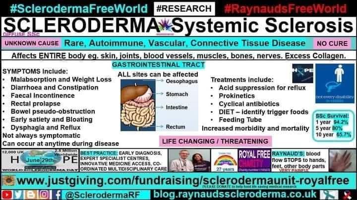 cosmicfairy444's tweet image. #GastroparesisAwareness #heartburn #acidreflux #bloating #malnutrition
blog.raynaudsscleroderma.co.uk/2018/05/gastro… #SclerodermaFreeWorld #RaynaudsFreeWorld #Research #Scleroderma #SystemicSclerosis #Raynauds #Autoimmune #RareDisease #NoCure #LifeChanging #ConnectiveTissue #BePartOfResearch #GERD