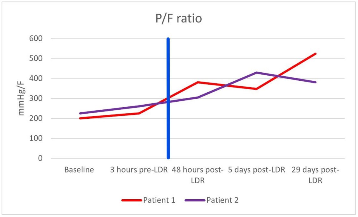 📈Highly Accessed Paper📈

💡"Low-Dose Radiotherapy for Severe COVID-19 Lung Disease—Have Meta-Analyses Accounted for Dose and Timing of Radiotherapy?" by Leonie Eastlake et al.

🔗Read the full article here: mdpi.com/2673-592X/5/2/…

#Radiation #OpenAccess #MDPI