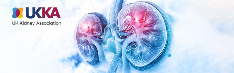 Sign the UKKA’s open letter to the Prime Minister

We hope you will agree this is an impending public health crisis that needs addressing, and we invite you to read the letter and add your name to support it. eu1.hubs.ly/H0mfCTd0