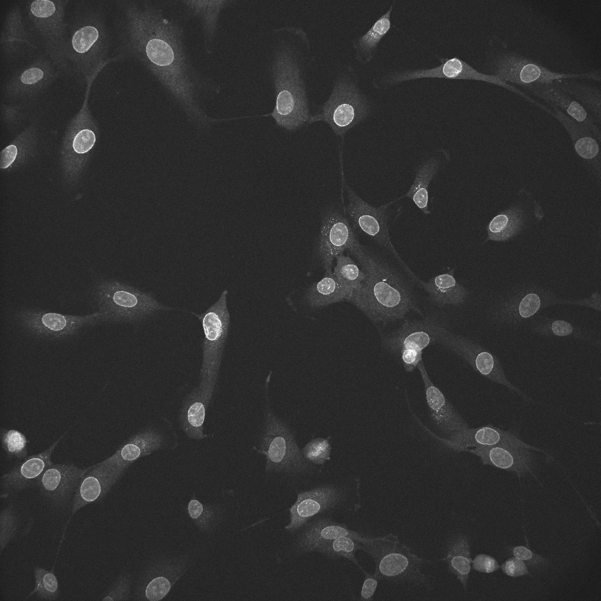 Thanks to 3i for imaging with the Aries 6510 - 6.5 micron, 95% QE - large field of view spinning disc camera

Find out more here:  tucsen.com/aries-6510-pro…
