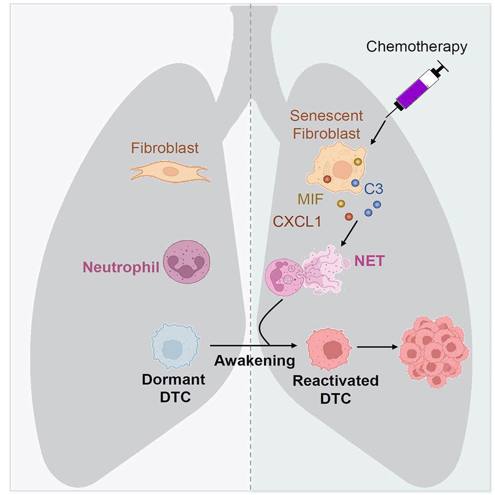 T:👉“Kemoterapi ilaçları kanser metastazını, yani yayılmasını arttırıyor” iddiası sosyal medyada tekrar gündemde.

Bu iddiaya dayanak olarak gösterilen yeni bir çalışmayı da ele alarak, bilimsel çerçevede neyin gerçekten gösterildiğini anlatan bir bilgilendirme floodu...👇👇👇