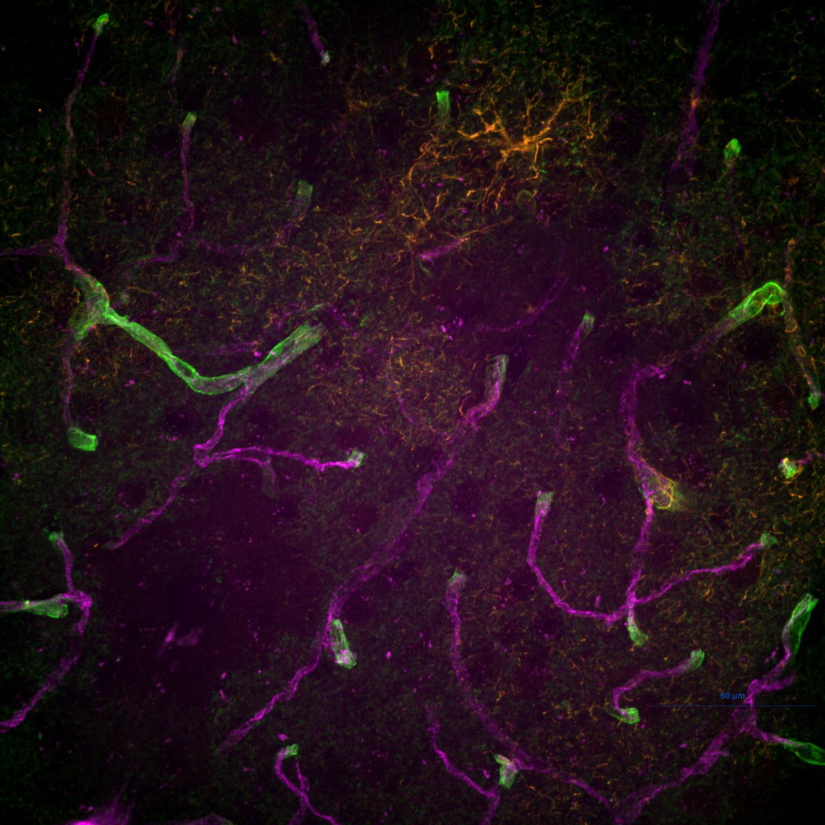 New #FluorescenceFriday image. This time from our own confocal microscope.

Green: AQP4 (astrocyte endfeet), Orange: GFAP (astrocyte), Magenta: CD31 (blood vessels). Image from our undergraduate Ayan Chaudhry and our grad student Mandi Lichtenstein

#AstrocyteLove