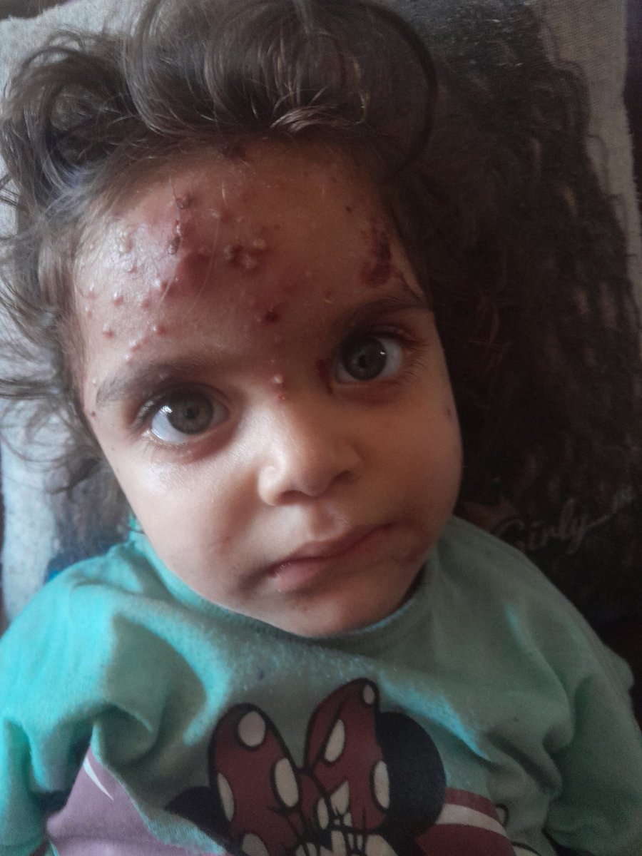 Humanity is gone... today we begin surviving on water and salt.

If you see this reply with a dot.
gofund.me/f798e8be