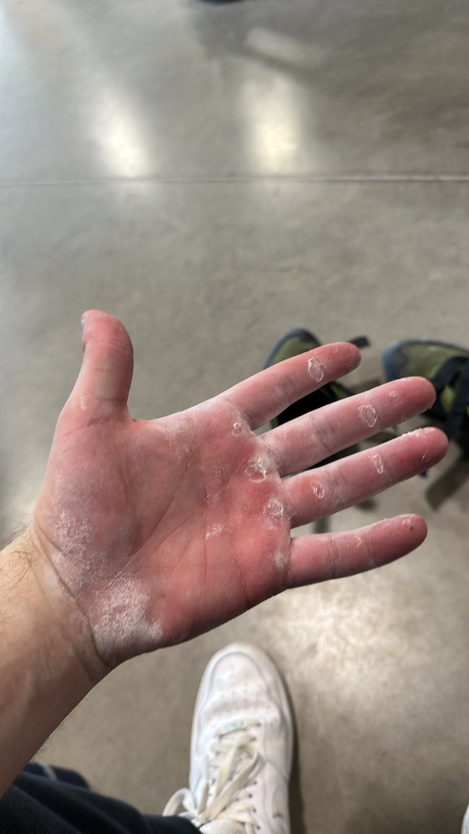 Owen Butterfield tweet media