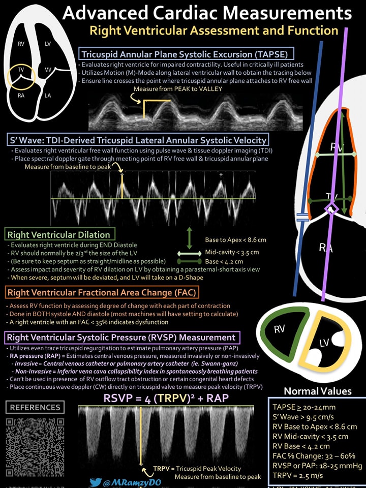 ZHeart11768530's tweet image. 🔴Advanced Cardiac Measurement ⤵️ Echocardiography

🔹Quantitative Measurements of #cardiac function using #POCUS.

🔹Dr. Mark Ramzy . ED/ICM Doc
 #Cardiology #FOAMed #MedEd #medstudent #paramedic #Cardiology #CardioEd #medtwitter #meded #CardioTwitter #cardiotwiteros