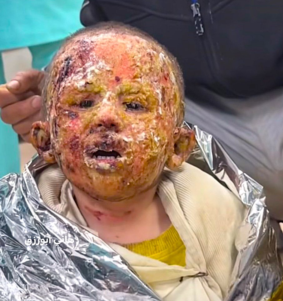 ✅ Terörist Katil işgalci israil bu katliamları;
Müslüman ülke liderlerinin SESSİZLİĞİNDEN GÜÇ alarak yapıyor

⛔️Gazze İnsanım diyen herkesin DAVASIDIR

➡️ Gazze aç susuz - SESSİZ KALMA  ⬅️

#StopTheGazaOccupation