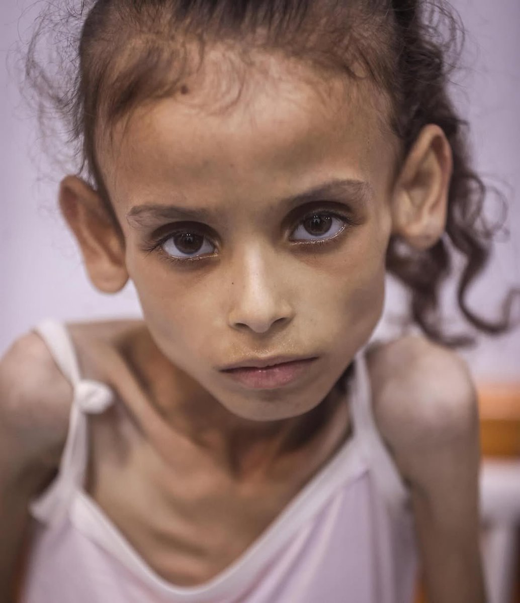 Her name is Maryam, she is starving. #Gaza