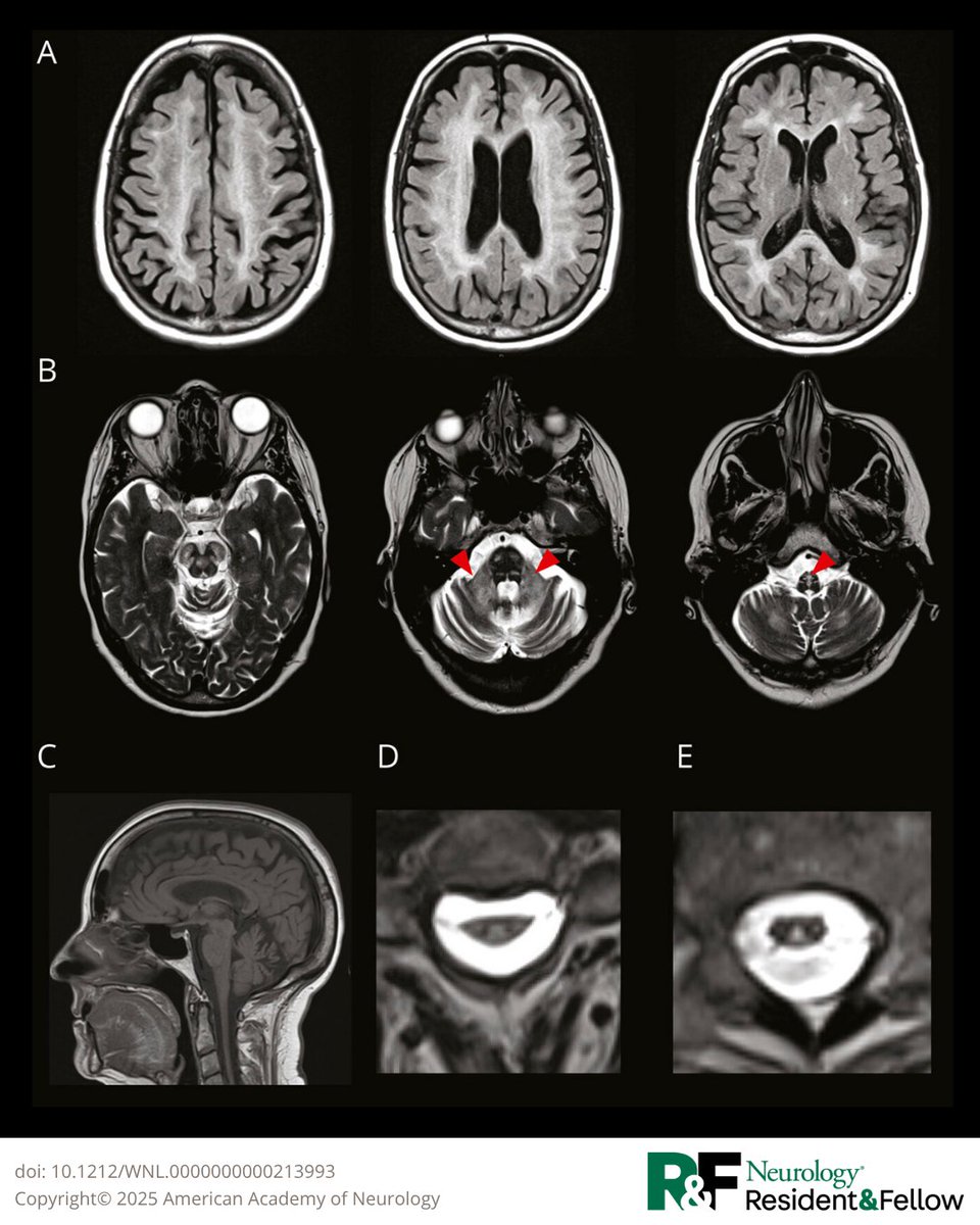 Neurology Journal tweet media