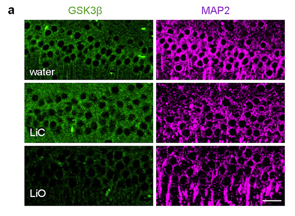 Here is a brief summary of the new "Nature" paper on Alzheimer's Disease as caused by lithium deficiency in the brain. Think "scurvy". 
Slide 1 > they analyzed the concentrations of 27 different elements in the brain, for normal versus mentally-impaired older people. They found a