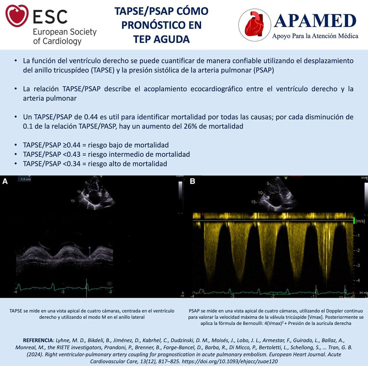 🫀𝗧𝗔𝗣𝗦𝗘/𝗣𝗦𝗔𝗣 <𝟬.𝟰𝟰 = ↑𝗺𝗼𝗿𝘁𝗮𝗹𝗶𝗱𝗮𝗱 𝟮𝟲%
𝗣𝗿𝗼𝗻𝗼́𝘀𝘁𝗶𝗰𝗼 𝗧𝗘𝗣 𝗮𝗴𝘂𝗱𝗮⚠️
<a href="/apamed_oficial/">APAMED | Medicina de calidad</a>
⬇️⬇️⬇️⬇️

📊 𝙍𝙞𝙚𝙨𝙜𝙤 𝙏𝙀𝙋:
≥0.44 = bajo
<0.43 = intermedio
<0.34 = alto🎯

🔬 𝙏𝘼𝙋𝙎𝙀/𝙋𝙎𝘼𝙋 = acoplamiento VD
Función sistólica/postcarga 💪