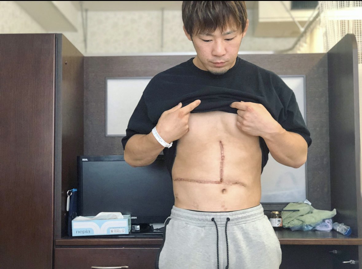 takasushota's tweet photo. ステージ4bの癌になったけど今が全盛期です https://t.co/7plfo6vVWp