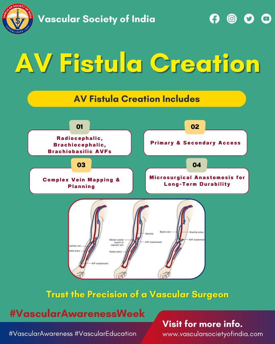 Vascular_India's tweet photo. 🩺 From AV fistula creation to complication repair & central vein angioplasty — vascular surgeons provide complete, precise care for dialysis access. Your AV fistula deserves expert hands.
#VascularAwarenessWeek #VascularAwareness #VascularEducation https://t.co/TPx2CicaAq