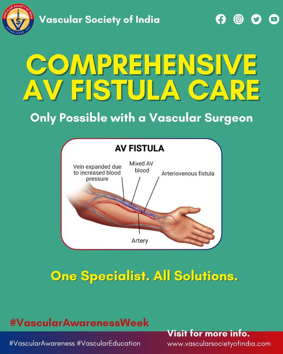 Vascular_India's tweet photo. 🩺 From AV fistula creation to complication repair & central vein angioplasty — vascular surgeons provide complete, precise care for dialysis access. Your AV fistula deserves expert hands.
#VascularAwarenessWeek #VascularAwareness #VascularEducation https://t.co/TPx2CicaAq