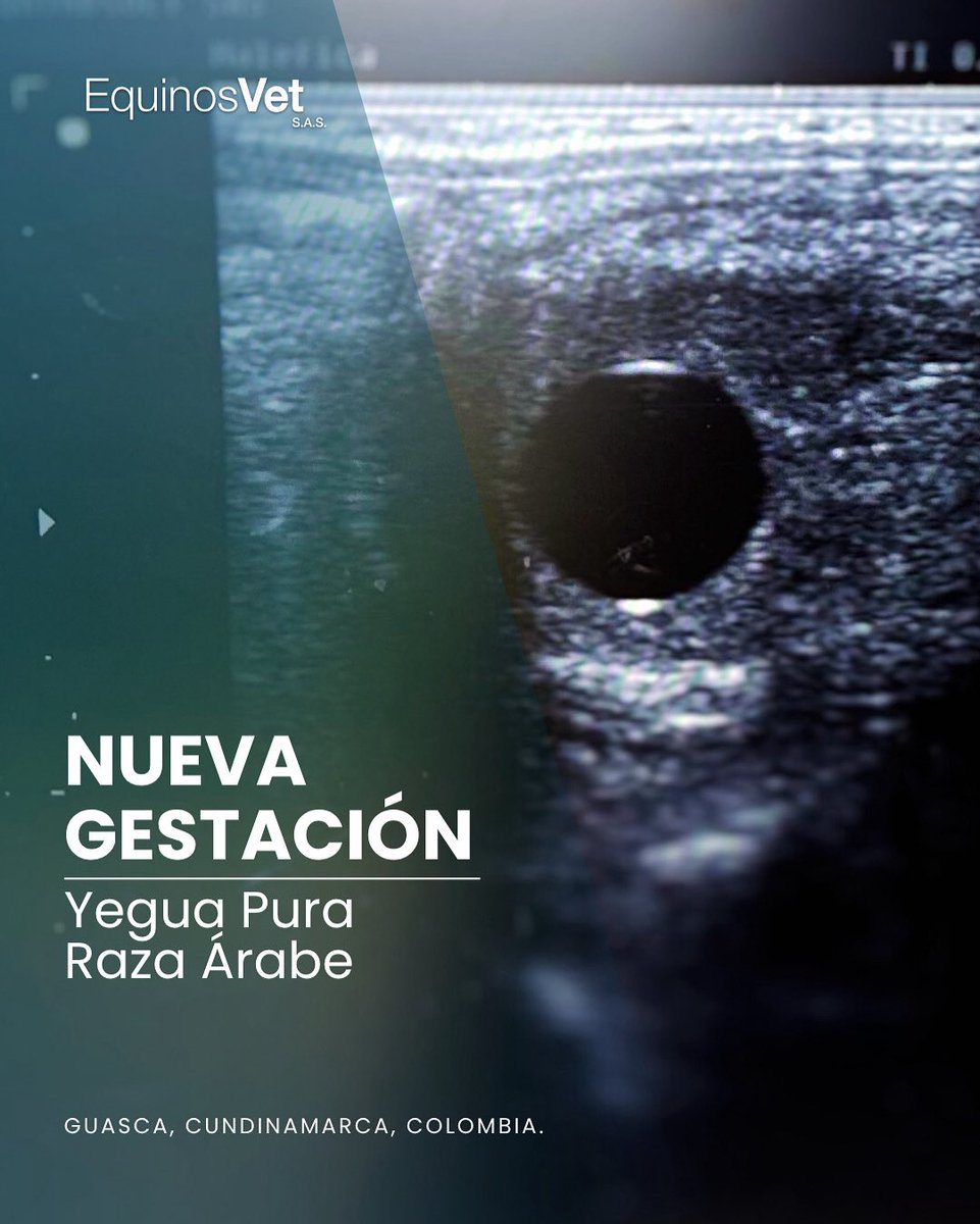 📸 Ecografía confirmando una nueva gestación producto de inseminación artificial con el gran reproductor EA Padanz, campeón padrillos, mejor cabeza machos AGROEXPO 2025.

🐎 Seguimos materializando sueños en #Guasca. 

#ReproducciónEquina
#Gestación #PuraRazaÁrabe
