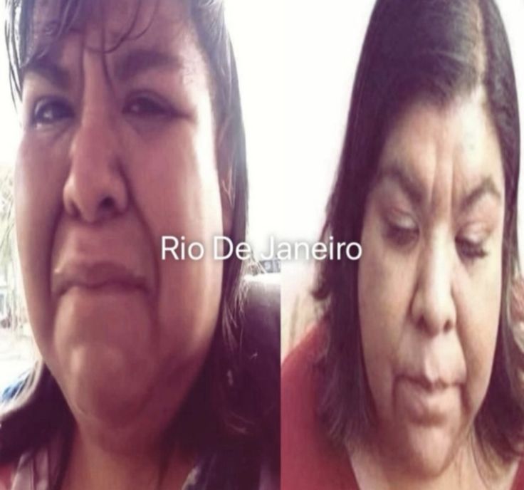 Hoy no empecé la anorexia