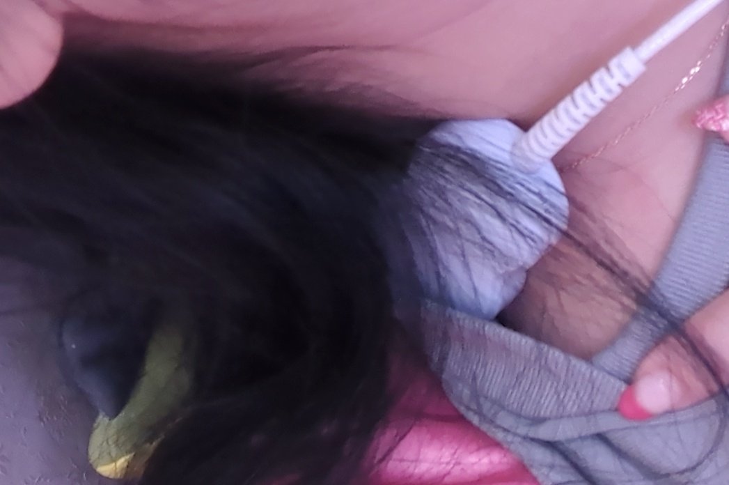 エイトしたら楽になってきた😭
開発してくれた偉大な方に大感謝
薬と違って副作用もないし
月額高いけど

線維筋痛症界隈の人すごい効く、ないと生きられないって人と
効果なしって人いるけど
効果あるタイプでよかった