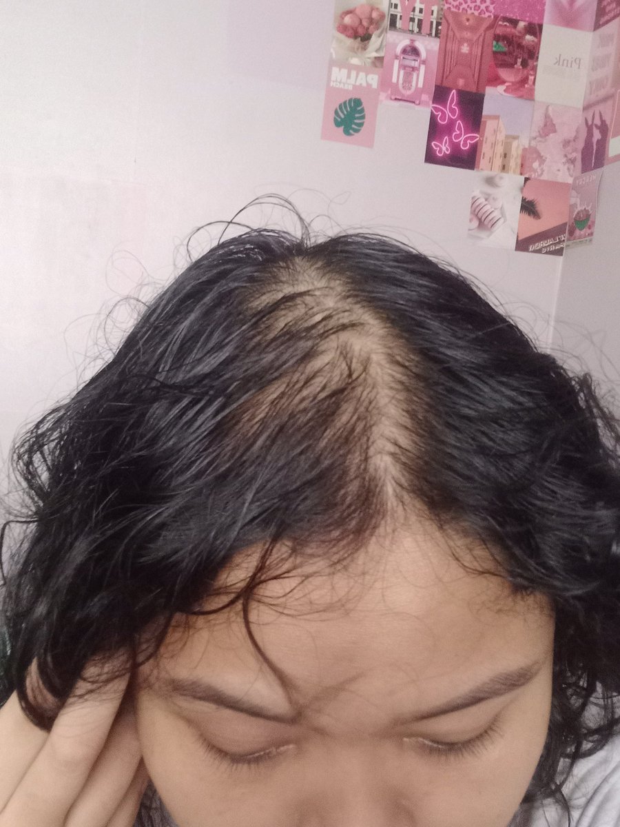 one month using putri's hair care (shampoo, and hair tonic for my hair and scalp, and hair cream for styling)