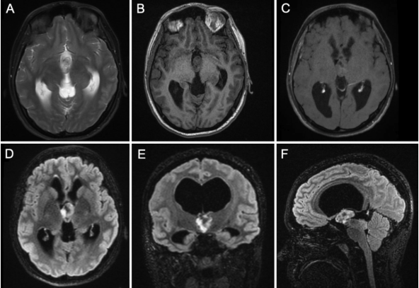 Journal of Neurosurgery tweet media