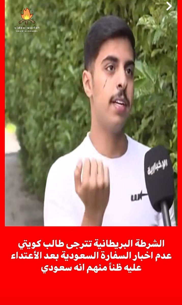لما يكون عندك دوله قادره تحميك كمواطن في اي بلد هنا النتيجه الله يعز المملكه العربيه آلسعوديه حاميه حتى الخليج برا مو بس السعوديين الحمدلله على نعمه آلسعوديه 🇸🇦🇸🇦