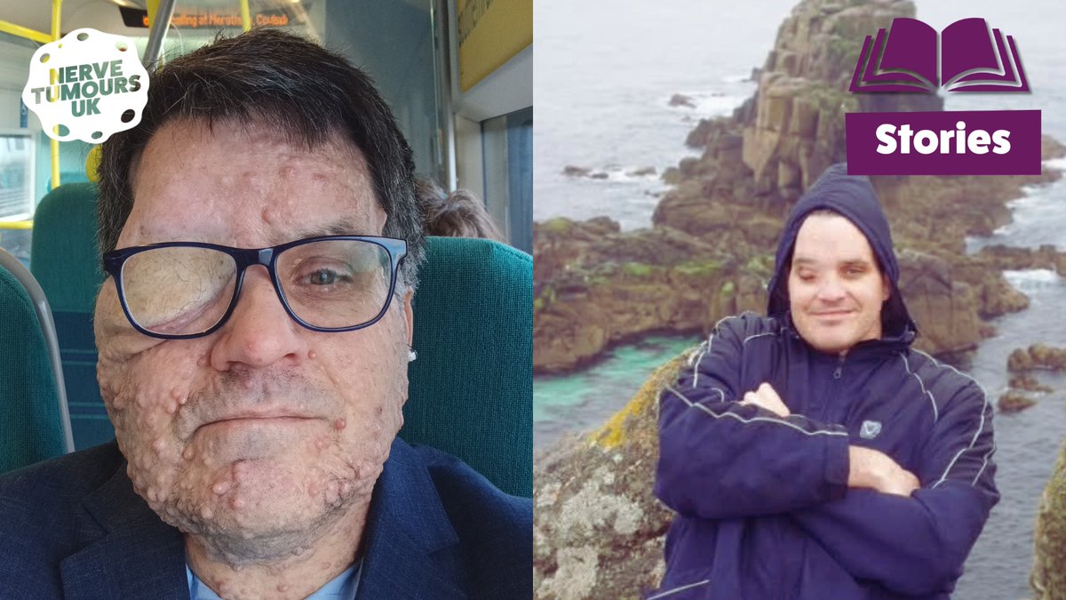 Nerve Tumours UK (@nervetumoursuk) on Twitter photo 🗣️"Beauty is not about symmetry or smooth skin. It is about courage, compassion and character and the #NF community has this in abundance." 🗣️
Read the next entry in Oliver Bromley's exclusive blog for Nerve Tumours UK
👉nervetumours.org.uk/news/olivers-b…
<a href="/OllieBromley/">Oliver Bromley</a> 🗣️"Beauty is not about symmetry or smooth skin. It is about courage, compassion and character and the #NF community has this in abundance." 🗣️
Read the next entry in Oliver Bromley's exclusive blog for Nerve Tumours UK
👉nervetumours.org.uk/news/olivers-b…
<a href="/OllieBromley/">Oliver Bromley</a>