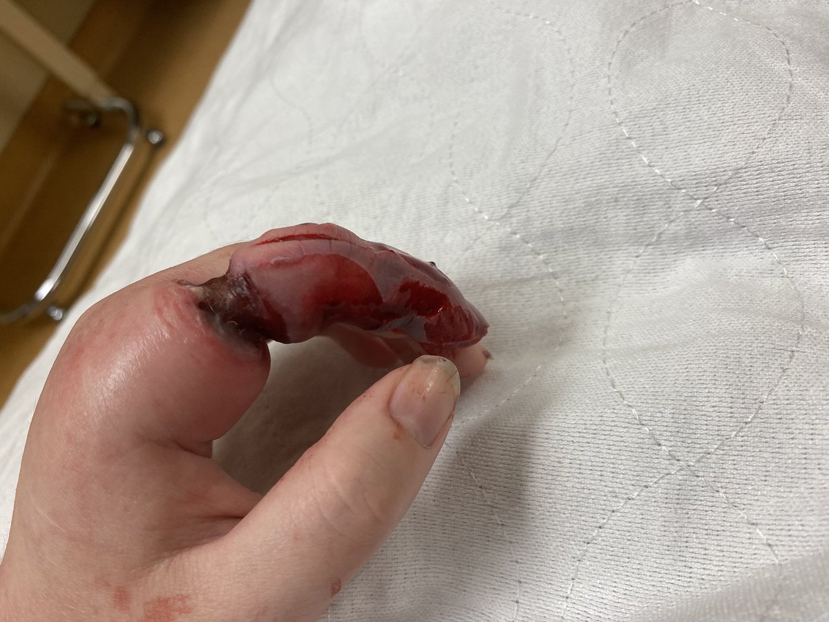 mila 🐞 tweet media